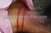 Moodbidri : Bhajrangdal activist’s murder triggers violence; lathi charge by cops